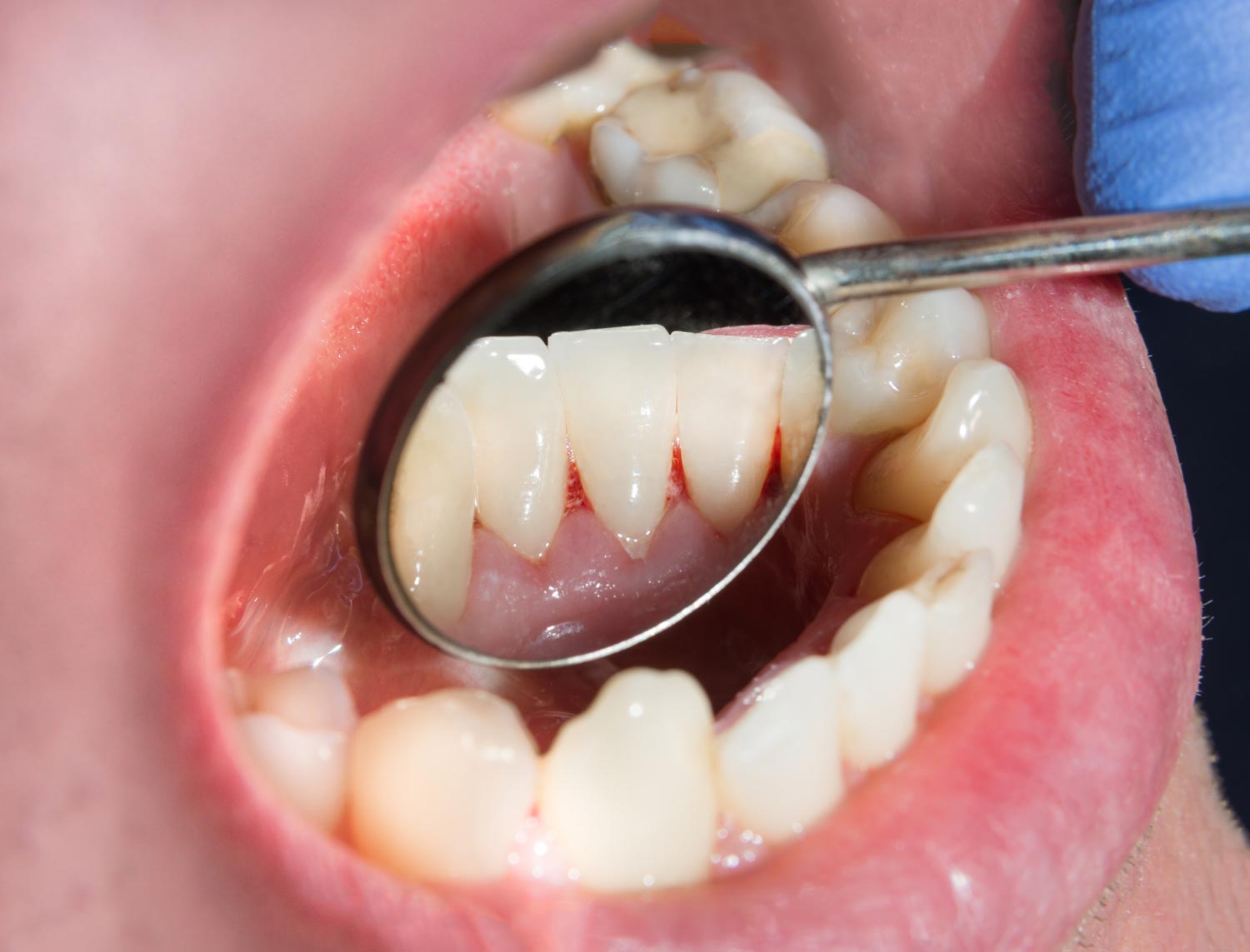 traitement dent boulogne billancourt